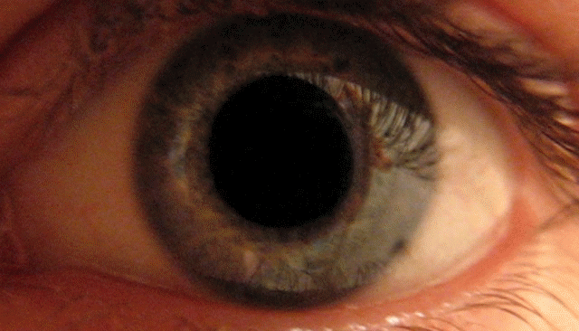 Pupil dilating